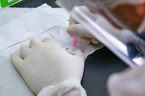 Procura por testes de covid aumenta em 40% nos laboratórios da Capital