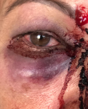 Ap&oacute;s briga de c&atilde;es, casal de idoso &eacute; agredido por lutador de jiu-j&iacute;tsu 