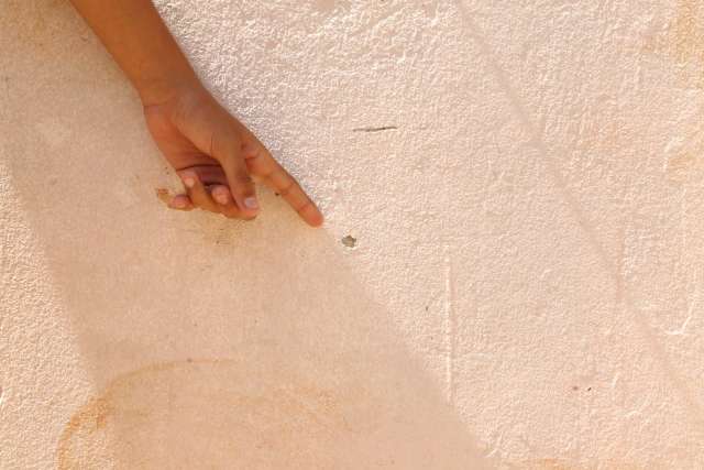 Bala perdida que feriu crian&ccedil;a de 11 anos tamb&eacute;m atingiu jovem de 22
