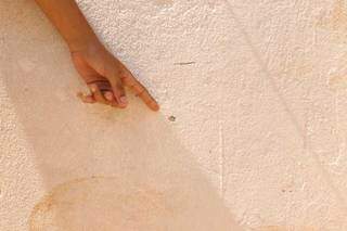 Bala perdida que feriu criança de 11 anos também atingiu jovem de 22 Bala perdida que feriu criança de 11 anos também atingiu jovem de 22