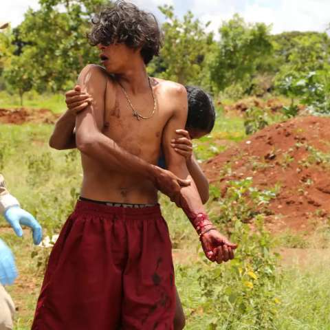 Jovem surta e sai sangrando com 2 facas nas m&atilde;os pelas ruas do Bom Retiro