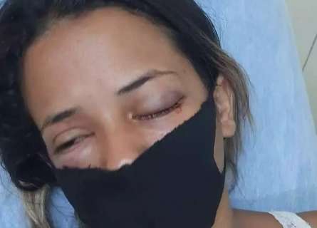 Desesperada, m&atilde;e pede ajuda para jovem espancada pelo ex