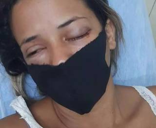 Desesperada, m&atilde;e pede ajuda para jovem espancada pelo ex