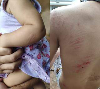 Pai e filha tiveram ferimentos leves após serem atacados por desconhecido em rua (Foto: Redes Sociais)