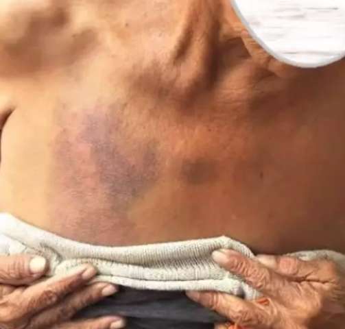 &Iacute;ndios v&atilde;o ao MPF denunciar tortura e amea&ccedil;as de l&iacute;der de aldeia 