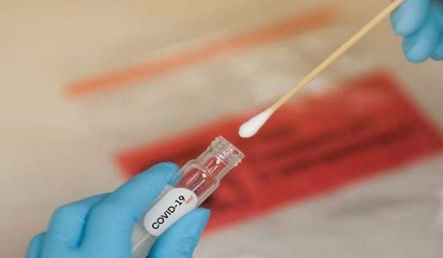 A nova cepa do coronav&iacute;rus vai provocar mais casos e mortes em MS?