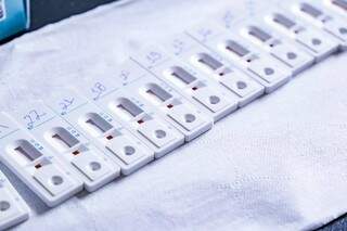 Testes rápidos enfileridas; exame é feito para detectar a covid-19 em pacientes (Foto: Kisie Ainoã/Arquivo)