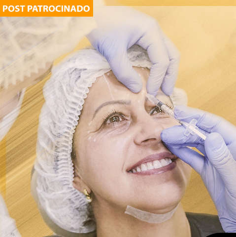 Fios de sustentação revolucionam estética facial, rápidos e acessíveis