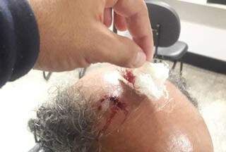 Ferimento provocado por coronhada na cabeça de idoso (Foto: Divulgação)