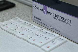Testes ráopidos analisando amostras de sangue em laboratório de Campo Grande. (Foto: Kísie Ainoã)