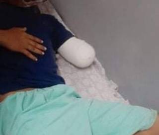 Rapaz está internado no hospital de Pedro Juan Caballero (Foto: Direto das Ruas)