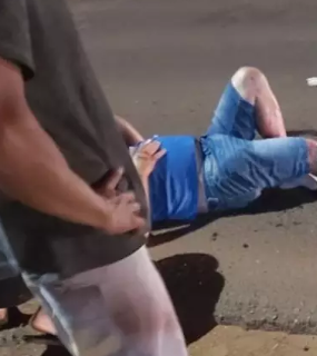 Homem tem perna dilacerada após cair de moto e ser atropelado 