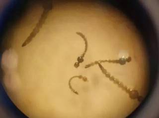 Larvas do mosquito da dengue observados por microscópio (Foto: PMCG/Divulgação)