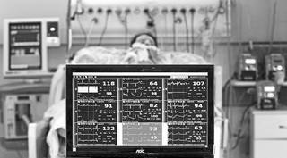 Paciente sendo monitorado em leito de UTI. (Saul Schramm) 