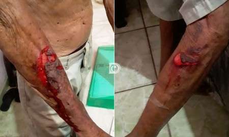 Idoso &eacute; roubado e amorda&ccedil;ado ao deixar &ldquo;amiga&rdquo; entrar em casa