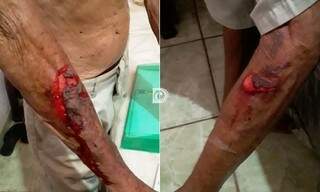 O idoso ficou com os braços cortados após ser amarrado. (Foto: Diário Corumbaense)
