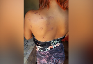 Adolescente &eacute; jogada de carro em movimento e atropelada durante briga
