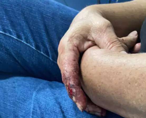Ju&iacute;za manda investigar pris&atilde;o de mulher que diz ter sido &quot;jogada em cambur&atilde;o&quot;
