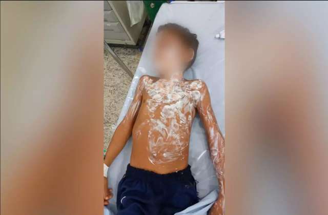 Pai garante que av&oacute; n&atilde;o se negou a salvar neto queimado com &aacute;lcool 