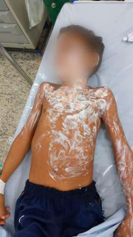 Av&oacute; &eacute; presa ap&oacute;s crian&ccedil;a com corpo queimado pedir socorro em posto de sa&uacute;de