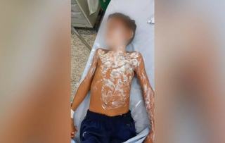À polícia, avó de menino queimado disse não ter obrigação de cuidar do neto À polícia, avó de menino queimado disse não ter obrigação de cuidar do neto