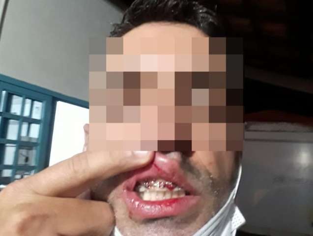 Agente sanitário é agredido a socos ao fiscalizar conveniência em MS 