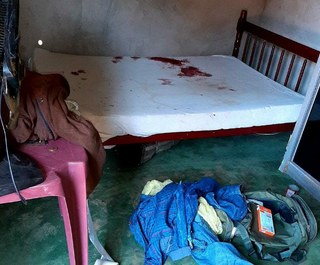 Enquanto dormia, homem &eacute; agredido a golpes de martelo por colega de trabalho 
