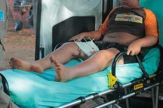 Grade perfurou perna direita de garoto de 9 anos, hoje, no São Conrado (Foto: Marcos Maluf)