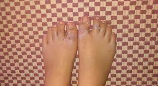 Os pés machucados da adolescente após ser encontrada (Foto: arquivo pessoal)