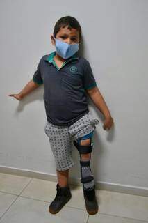 Thiago exibindo a prótese nova. (Foto: Ascom APAE)