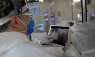 Médico analisa tomografia de tórax de paciente com covid-19. (Foto: Reuters)
