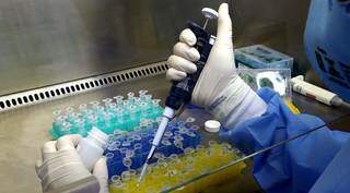 Exames de RT-PCR serão armazenados, conforme procedimento criado pelo Lacen (Foto/Divulgação)