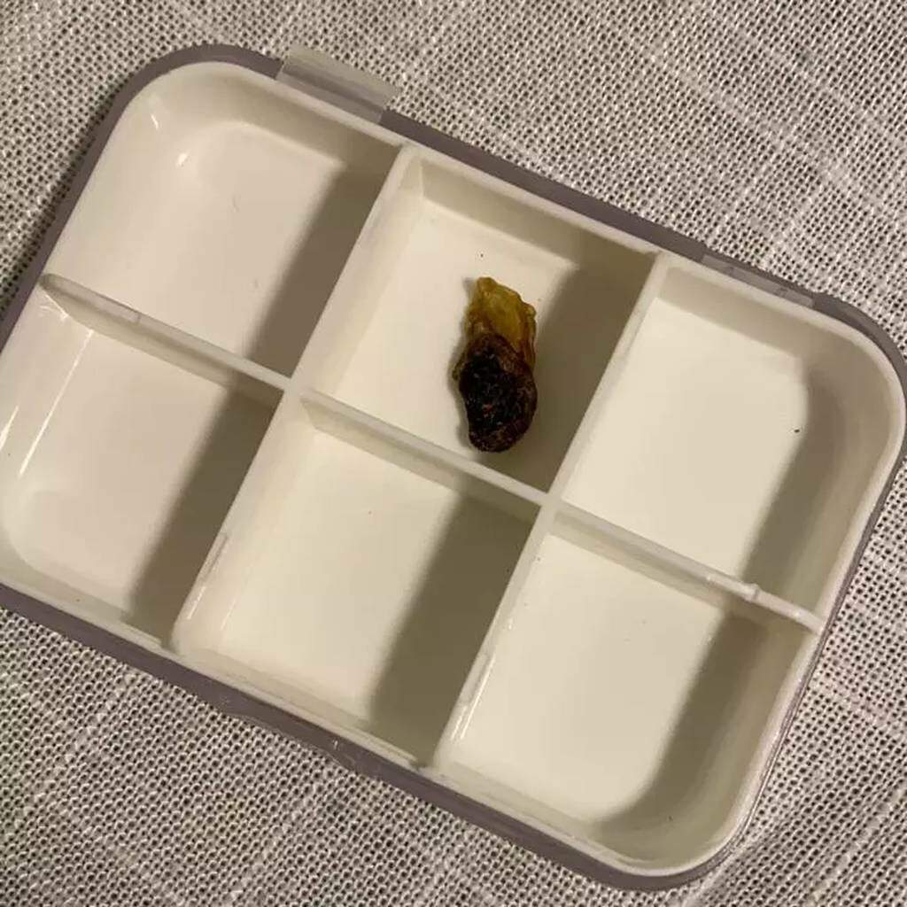 Tradição continua e mães guardam umbigo para plantar ou fazer joia ...
