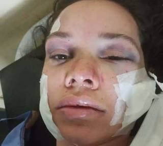 Raquel com curativos no rosto e pescoço após ser esfaqueada pelo ex-namorado (Foto: Direto das Ruas)