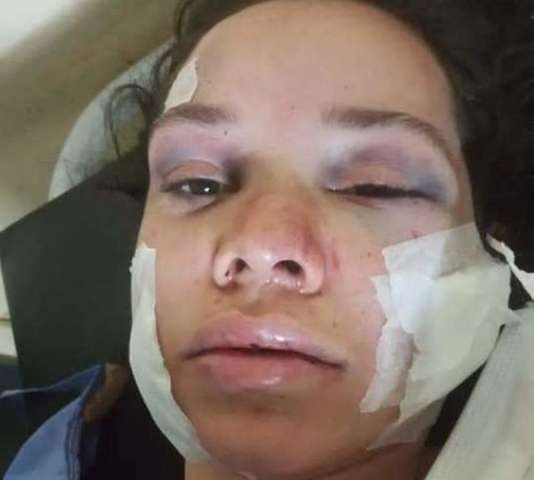 Homem que esfaqueou ex-namorada no rosto e pesco&ccedil;o &eacute; preso na fronteira