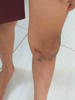 "Cão fugia direto" porque vivia preso em cubículo, diz homem que matou pitbull "Cão fugia direto" porque vivia preso em cubículo, diz homem que matou pitbull
