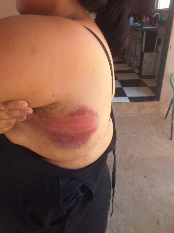 Balconista &eacute; agredida a pauladas at&eacute; desmaiar ap&oacute;s &quot;puxar ficha&quot; de companheiro