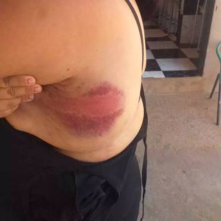 Balconista &eacute; agredida a pauladas at&eacute; desmaiar ap&oacute;s &quot;puxar ficha&quot; de companheiro
