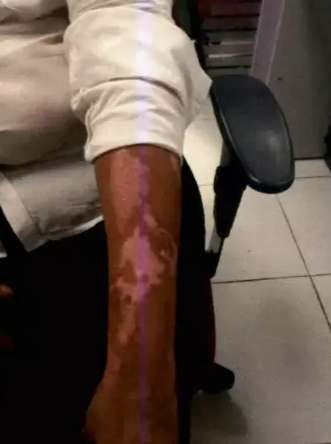 Por estupro, agressor volta para a cadeia 9 meses ap&oacute;s atear fogo &agrave; ex-mulher