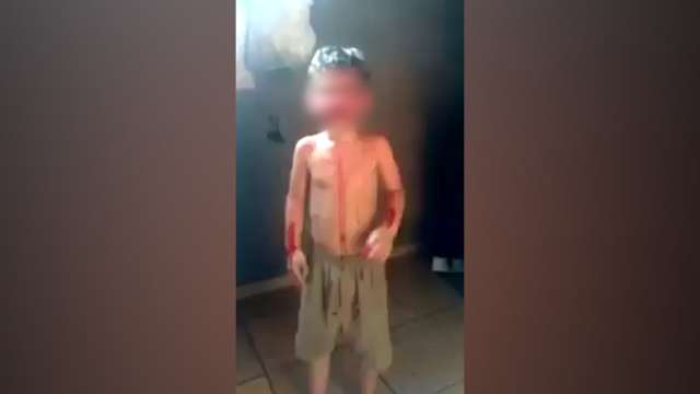 Pais de menino filmado cheio de sangue agora fogem de &quot;justiceiros&quot;