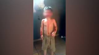 Menino de 3 anos aparece em vídeo cheio de sangue e chorando bastante; pai é suspeito de agressão. (Foto: Reprodução)