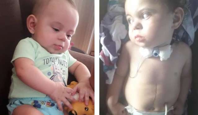 Alysson sofreu paralisia cerebral aos 7 meses e m&atilde;e implora por ajuda