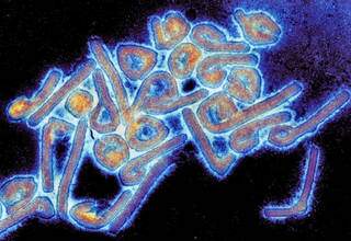Imagem microscópica do vírus de Marburg registrado no continente africano (Foto Divulgação)