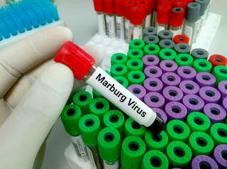 Manipulação do vírus em laboratório. (Foto: Agência Brasil)