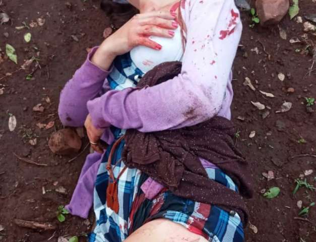 Por ci&uacute;me, adolescente de 16 anos esfaqueia rival, gr&aacute;vida de 5 meses