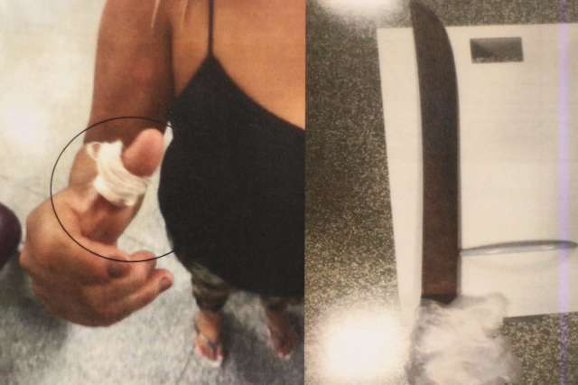 Padrasto &eacute; preso ap&oacute;s decepar orelha de enteado com fac&atilde;o 