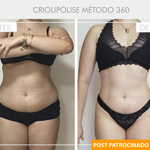 Em projeto verão da EmagreSee, elimine até 10 cm da cinturinha 