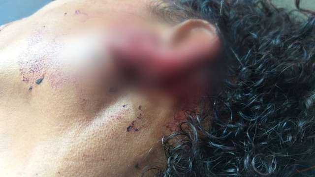 Catadora de latinhas &eacute; ferida a tiros por pistoleiros de moto na fronteira
