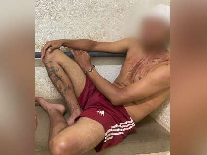 Por &quot;som alto&quot;, serventes de pedreiro apanham de PMs e fam&iacute;lia denuncia