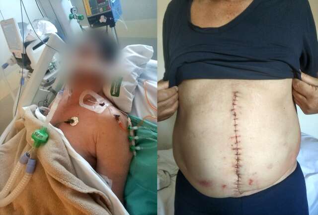 Espancado durante briga de c&atilde;es, idoso perde o ba&ccedil;o e passa 9 dias na UTI
